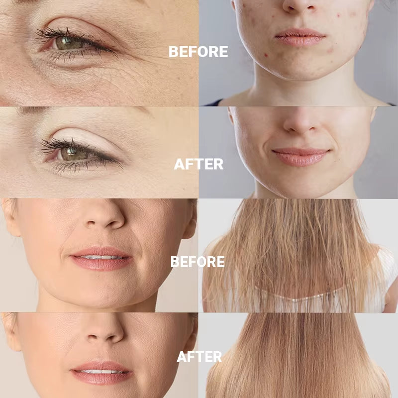 High Frequency Therapy Wand Professional Machine Skin Care Skin Tightening Device Beauty Products anti Wrinkle Face Clean