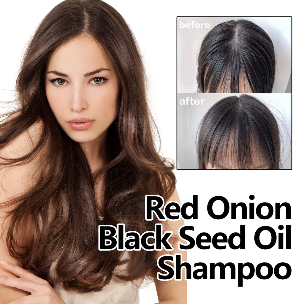 Red Onion Shampoo Black Seed Oil Hair Care Shampoo Hair Care Cleansing Scalp Refreshing Shampoo Hair Care Oil
